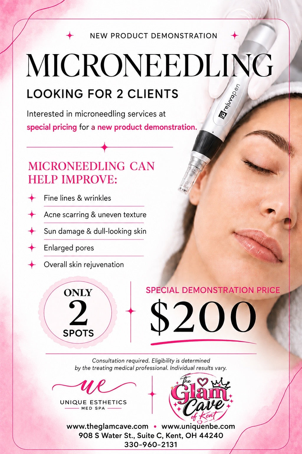 Microneedling Demonstration