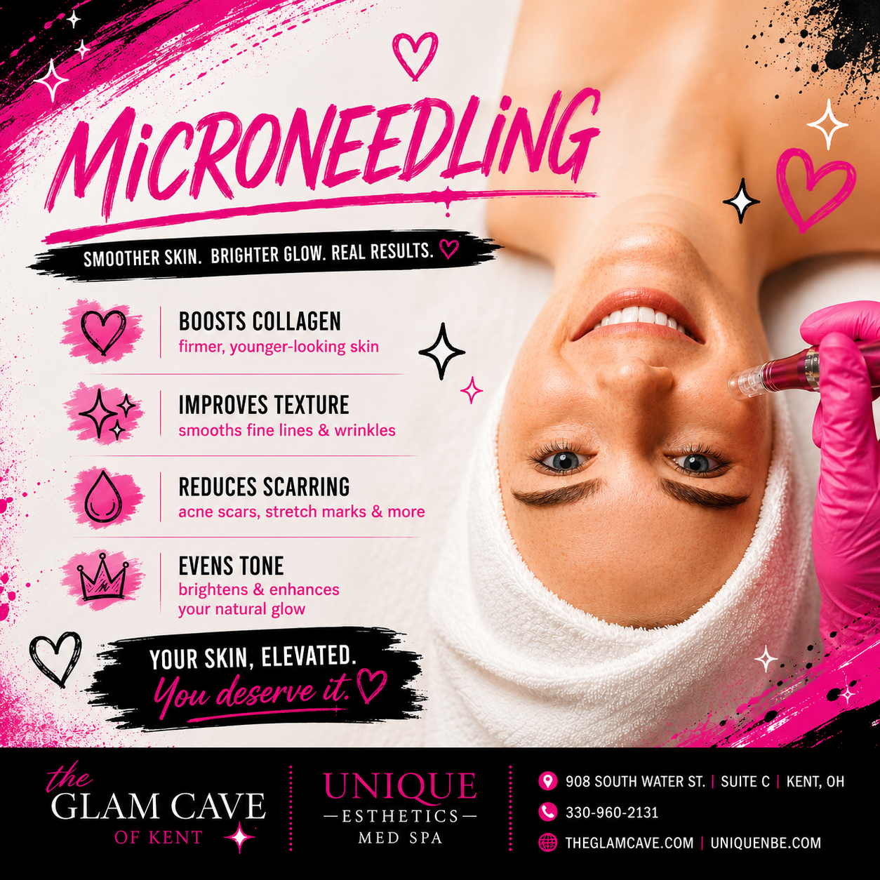 MicroNeedling